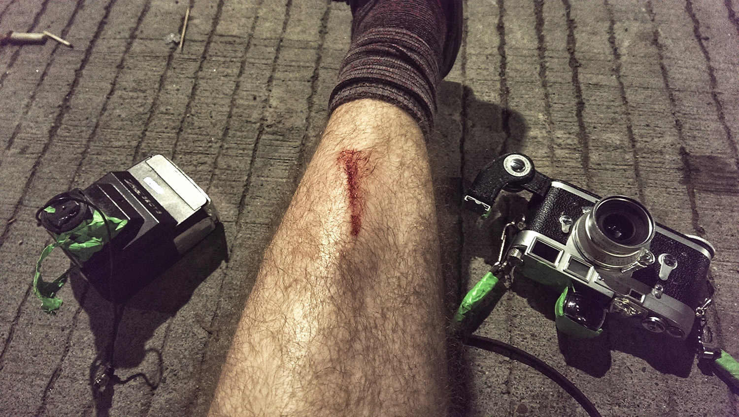 Broken Skin and Broken Camera