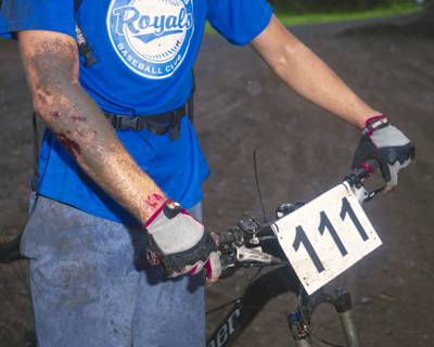 Crashed Mountain Biker, Duluth, Minnesota, August 2014